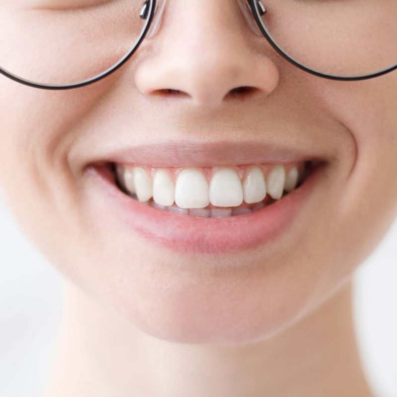 Äesthetische-Zahnheilkunde